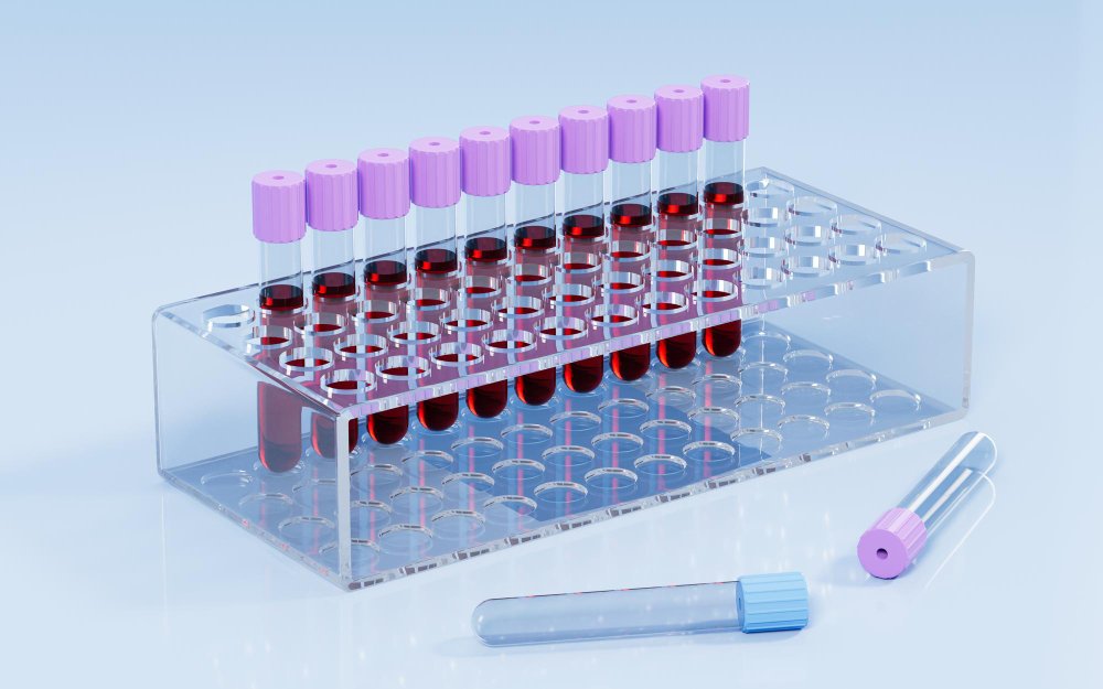 Blood Collection tubes Manufacturers in Mehsana