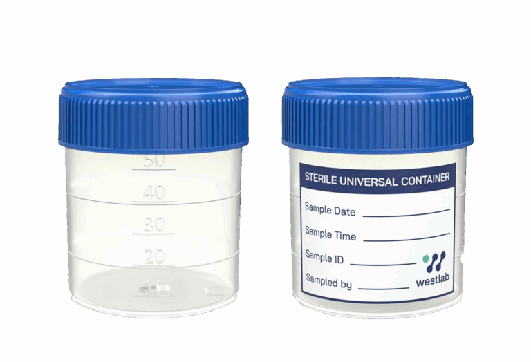 Sample Containers (urine, sputum, stool, etc.)