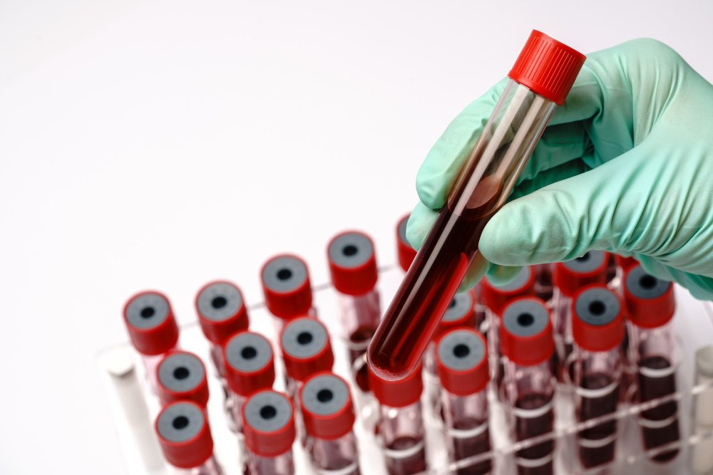 Avoid These Common Mistakes While Using Blood Collection Tubes