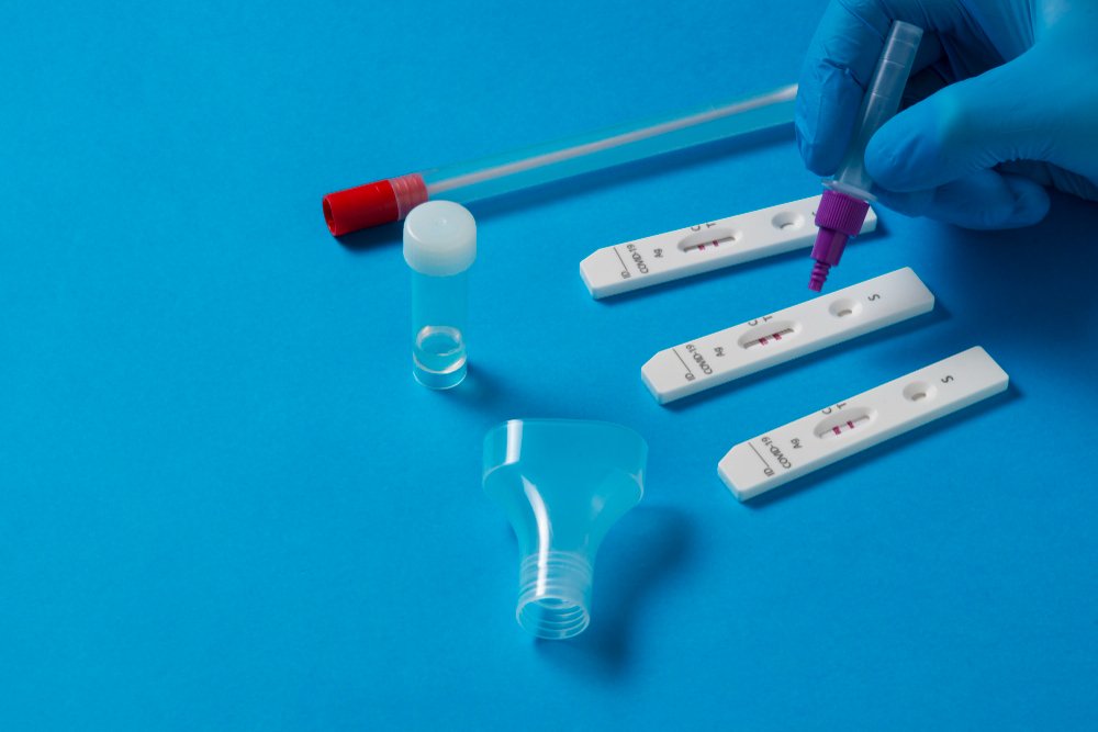 Using Home Test Kits? Tips from a Diagnostic Test Kit Manufacturer in Ahmedabad