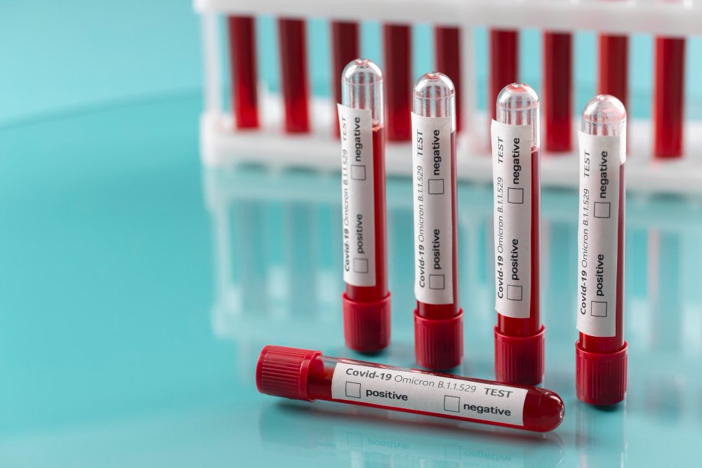 A Step-by-Step Guide to Safe Handling and Disposal of Blood Collection Tubes