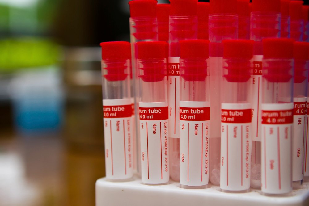Blood Collection Tubes Manufacturers in Ahmedabad: Innovations for Safety