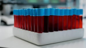 Complete Guide to Modern Blood Collection Tubes