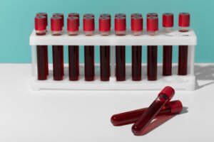 India’s Leading Blood Collection Tubes Manufacturer
